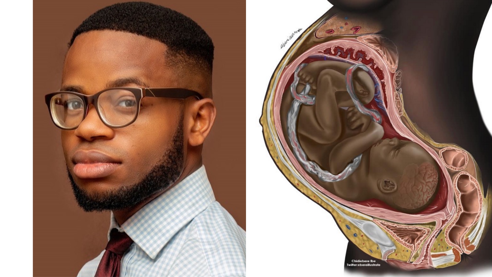 A Nigerian medical student’s illustration of a Black foetus goes viral