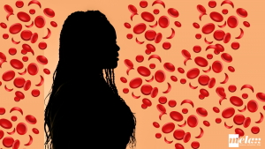 Woman with sickle cells