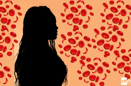 Woman with sickle cells